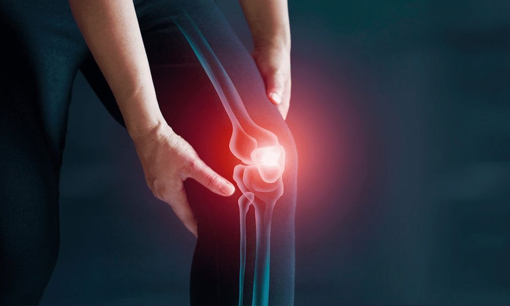 Kalça Kireçlenmesi Tedavisi Kalça Kireçlenmesi Tedavisi