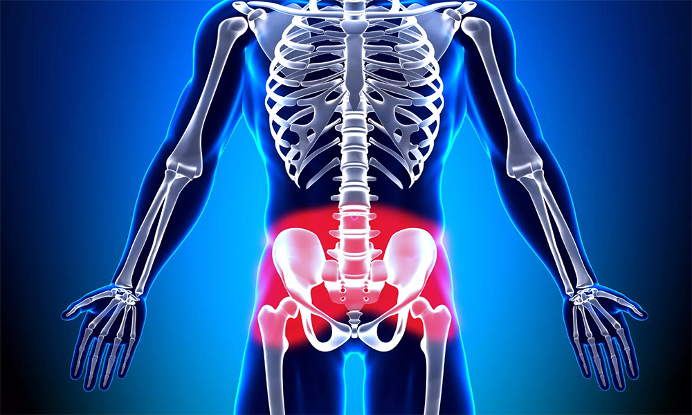 Kalça Osteoartrit Tedavisi Kalça Osteoartrit Tedavisi