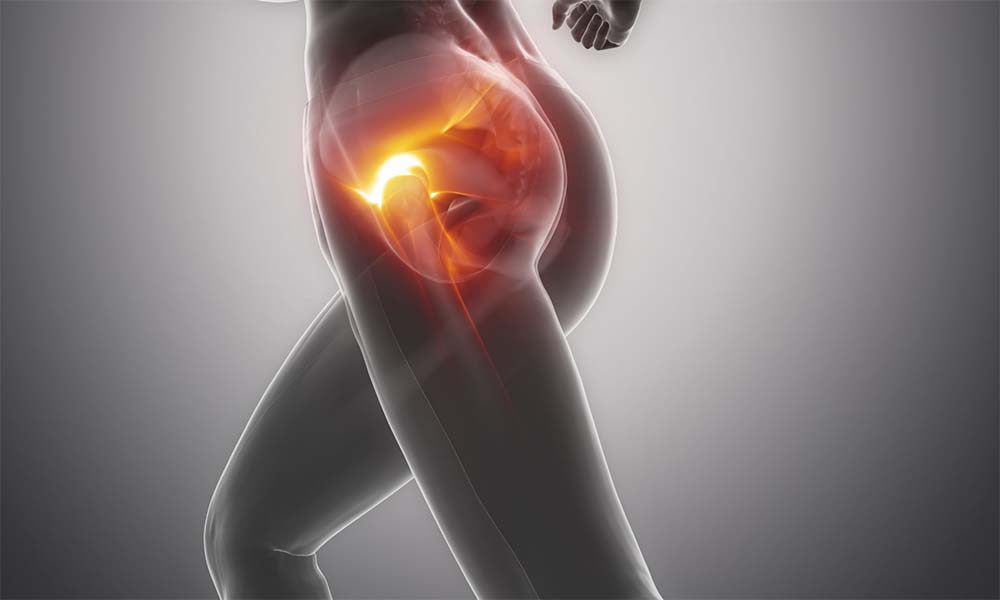 Total Kalça Protezi Ameliyatı Sonrası Total Kalça Protezi Ameliyatı Sonrası