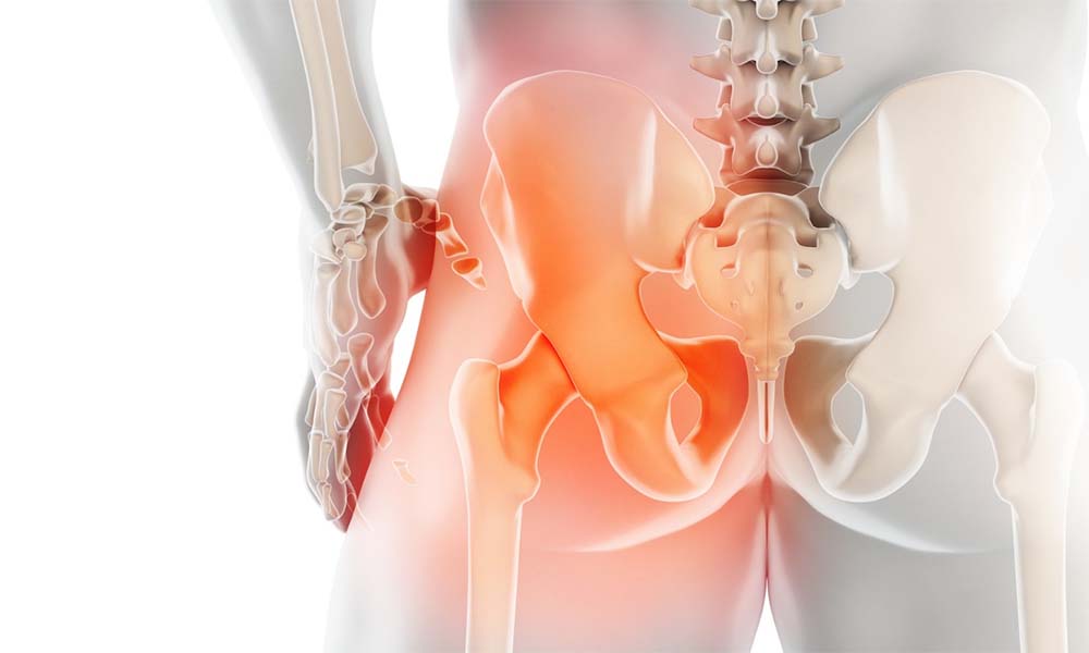 Total Kalça Protezi Ameliyatı Sonrası Total Kalça Protezi Ameliyatı Sonrası