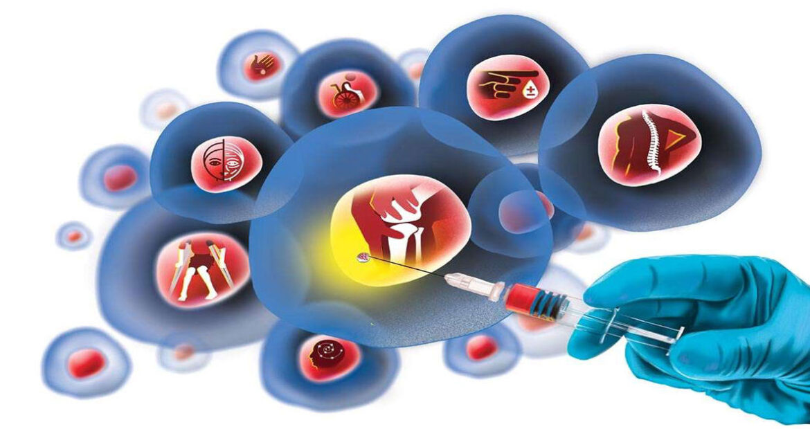 Kök Hücre Tedavisi Kök Hücre Tedavisi
