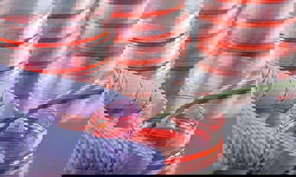 Kök Hücre Tedavisi Kök Hücre Tedavisi