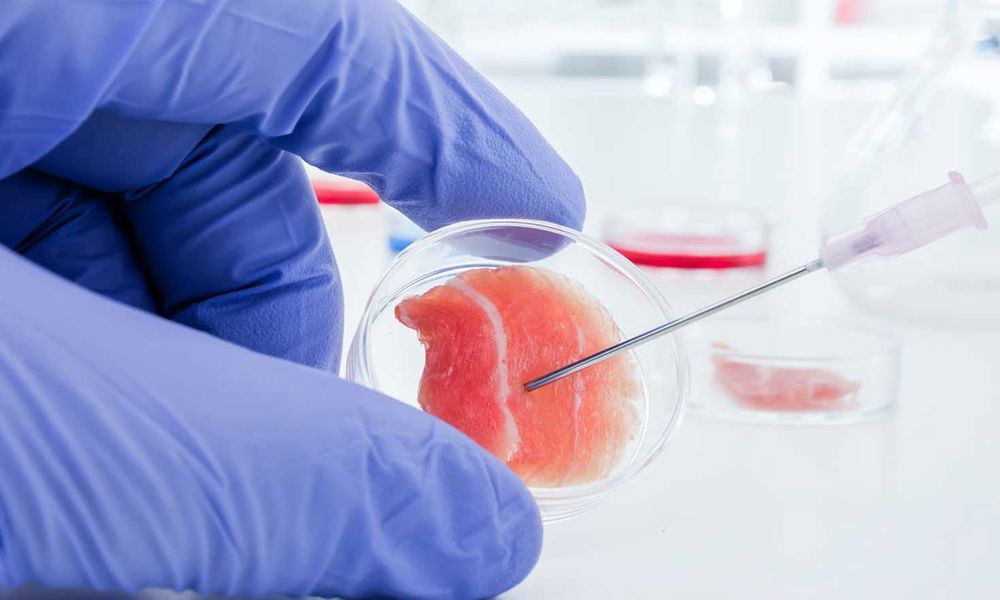 Kök Hücre Tedavisi Kök Hücre Tedavisi